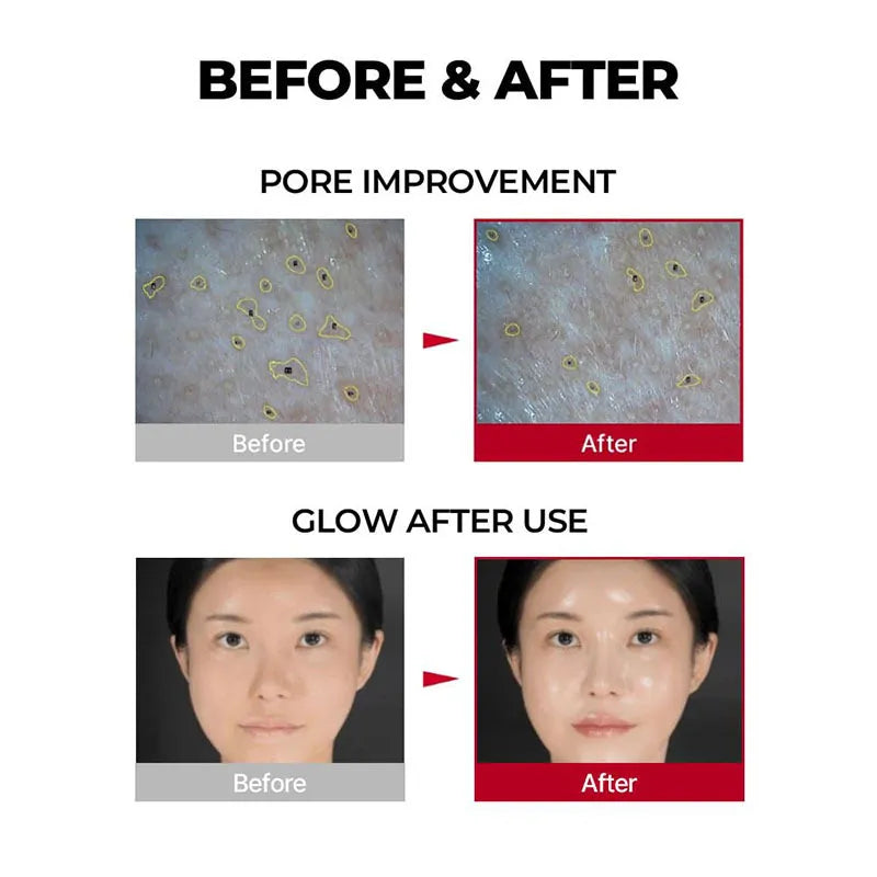 Tightening Facial Mask